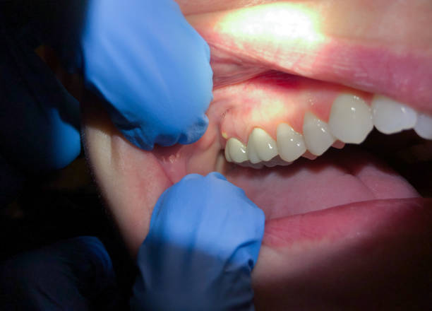 Best 24-Hour Emergency Dentist in Granite Shoals, TX